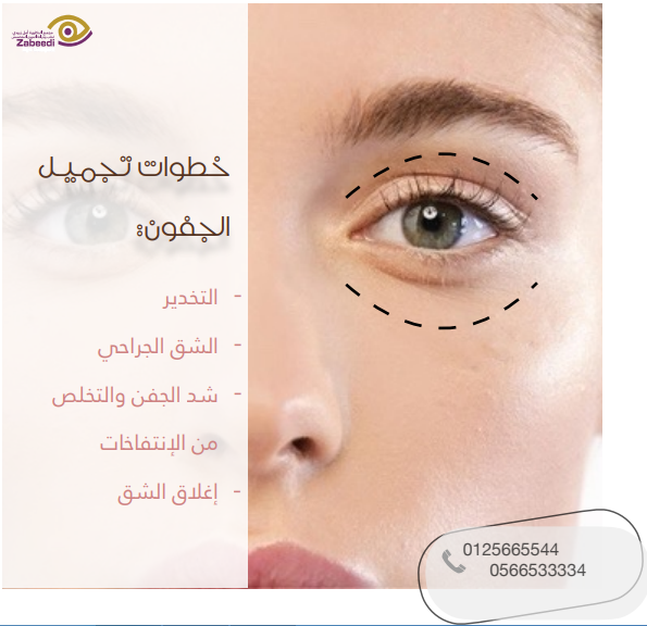 Beauty Tips for Eyelid